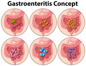 Gastroenteritis in Drawings